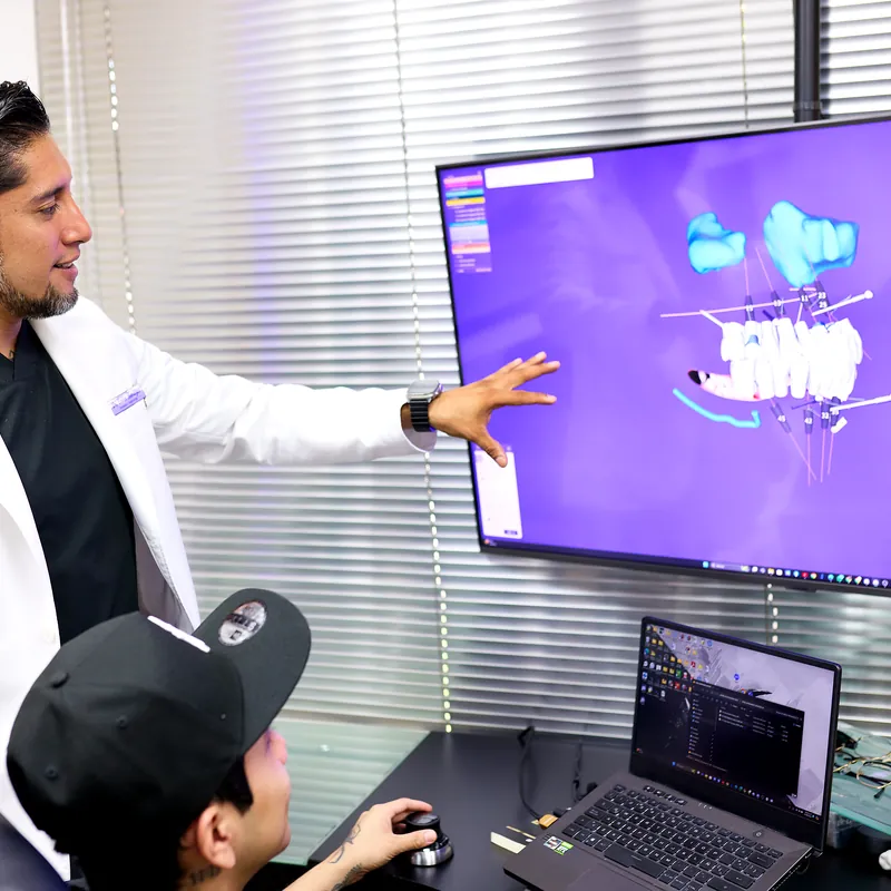 Prótesis e Implantes Dentales en Dental Spekter Cuernavaca