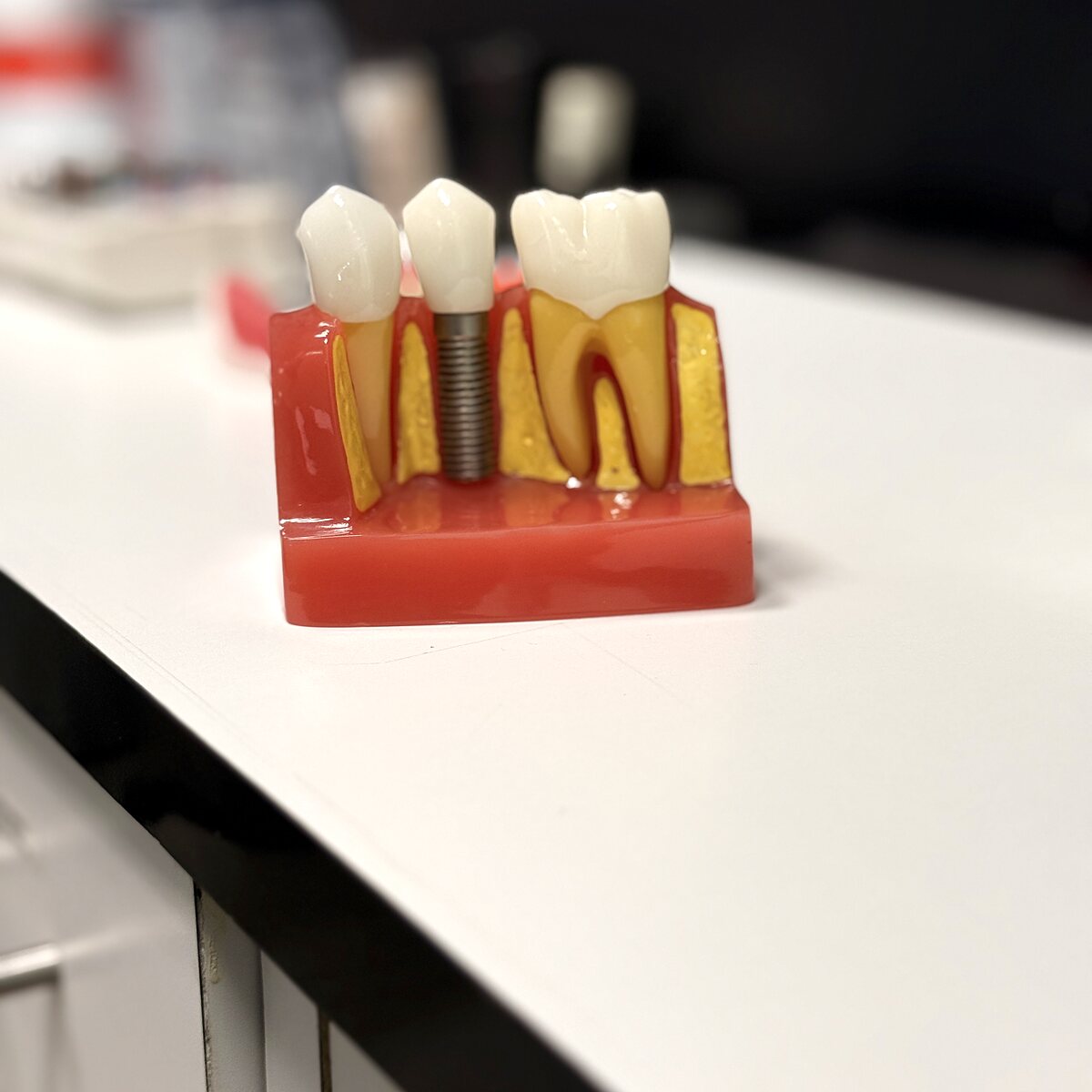 Prótesis e Implantes Dentales
