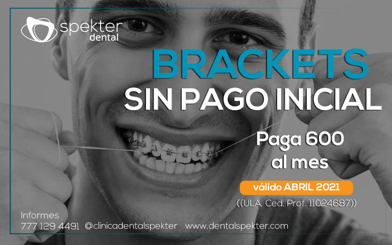 Brackets sin pago inicial
